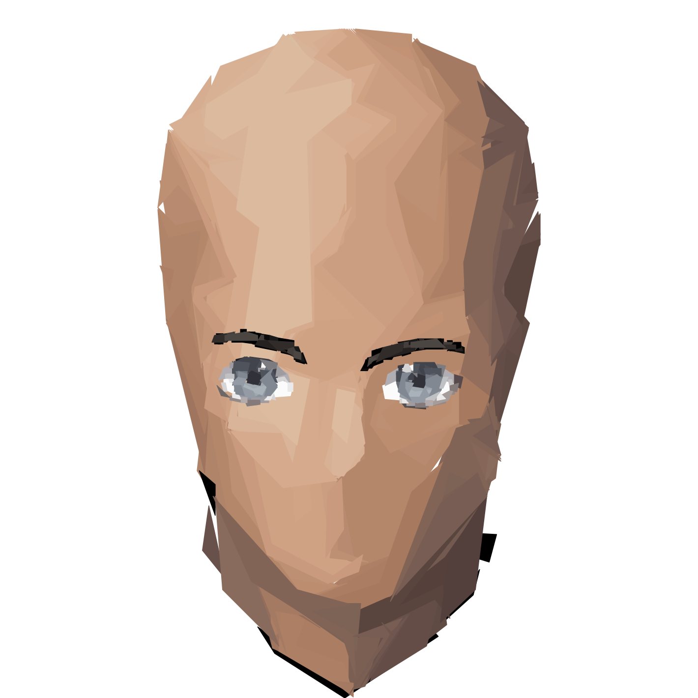 Eyes: Normal